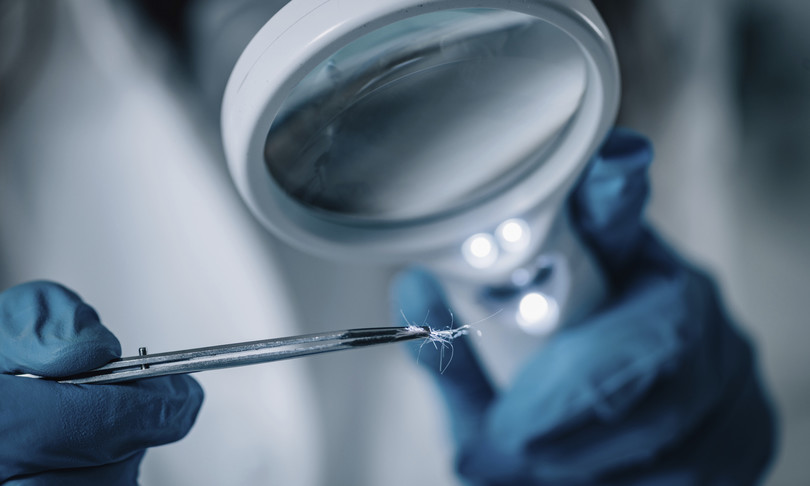 Coronavirus geni anticorpi risposta forme gravi