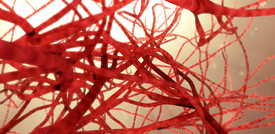 Vasi sanguigni elettronici per le arterie danneggiate