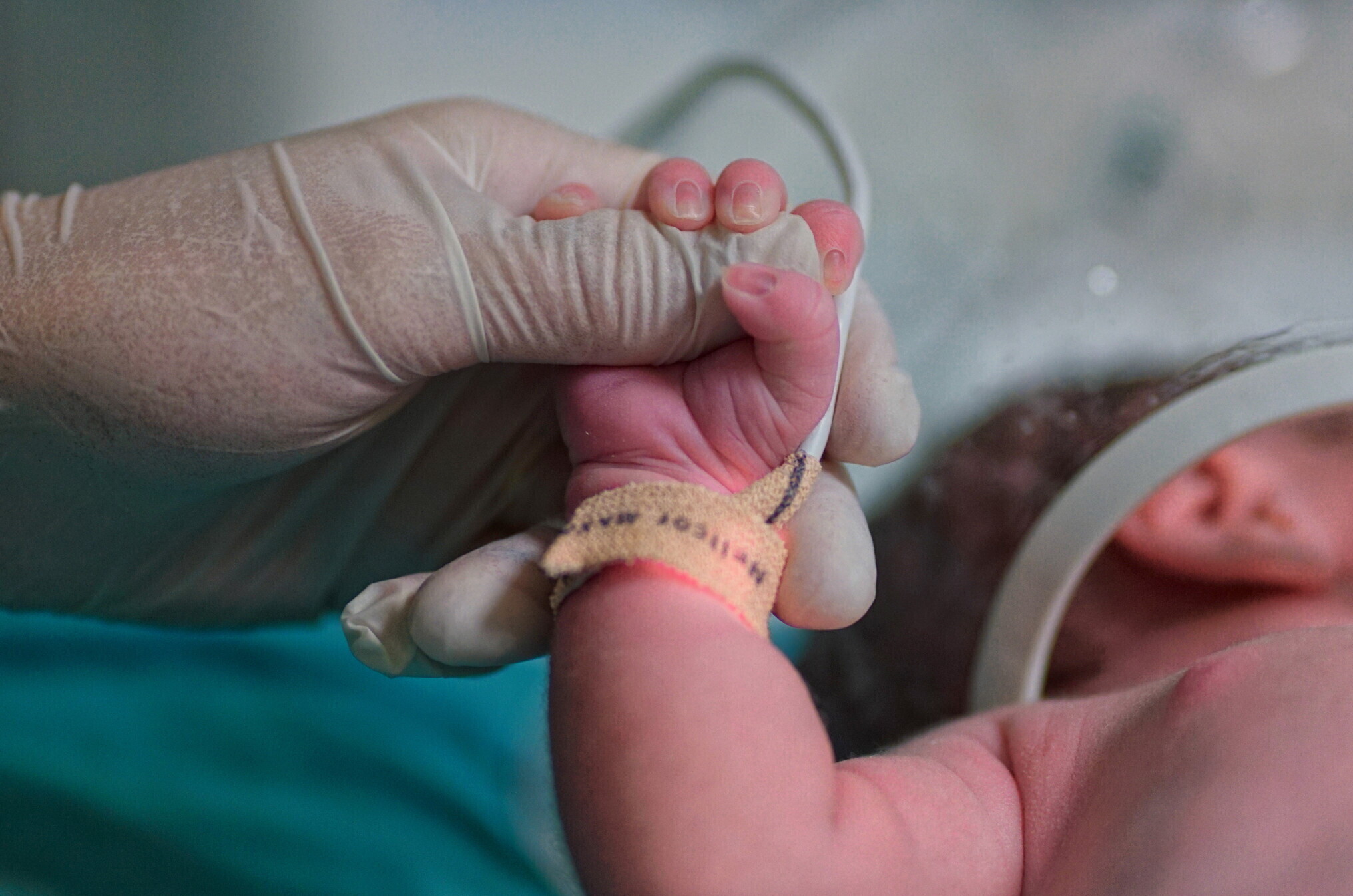 Dopo il trapianto di utero è possibile avere figli