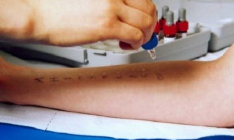 Bambino Gesu mezzo miliardo bambini e ragazzi soffre allergie