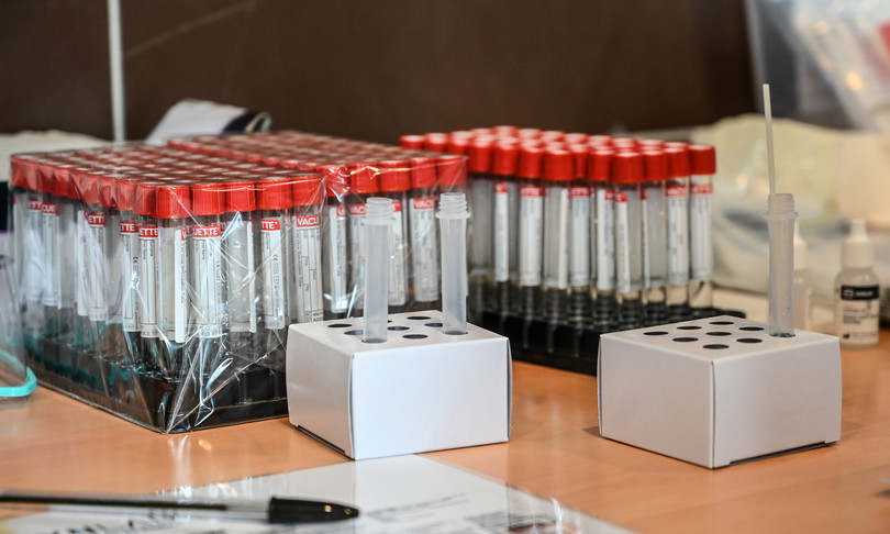 nuovo test sierologico anticorpi covid