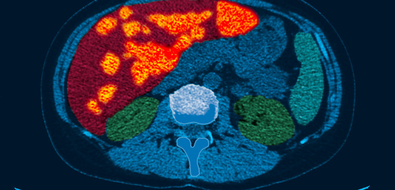 La Stanchezza Non E Sintomo Di Un Fegato Malato