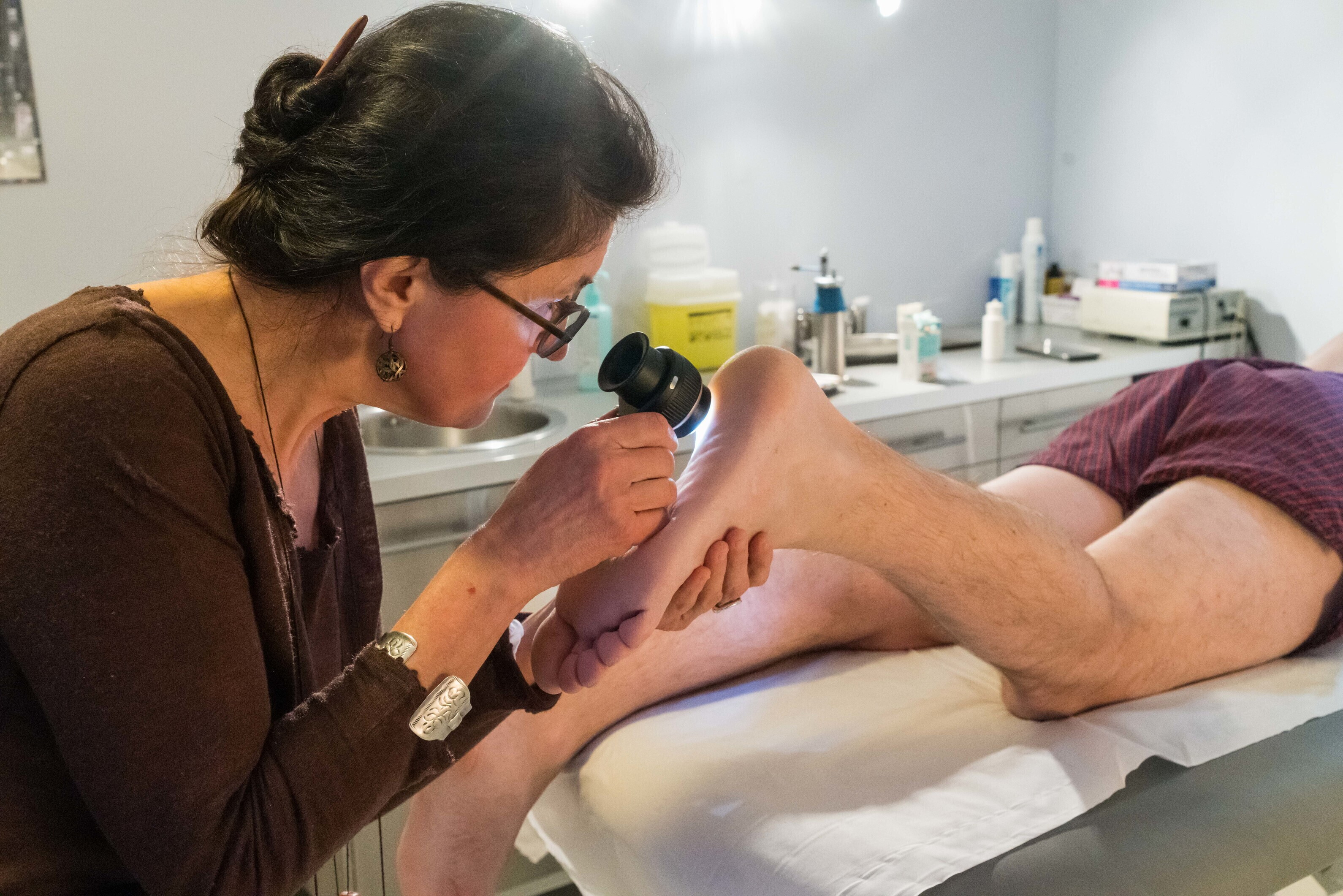 Melanoma, in 3 casi su 4 i più pericolosi sono i nei nuovi