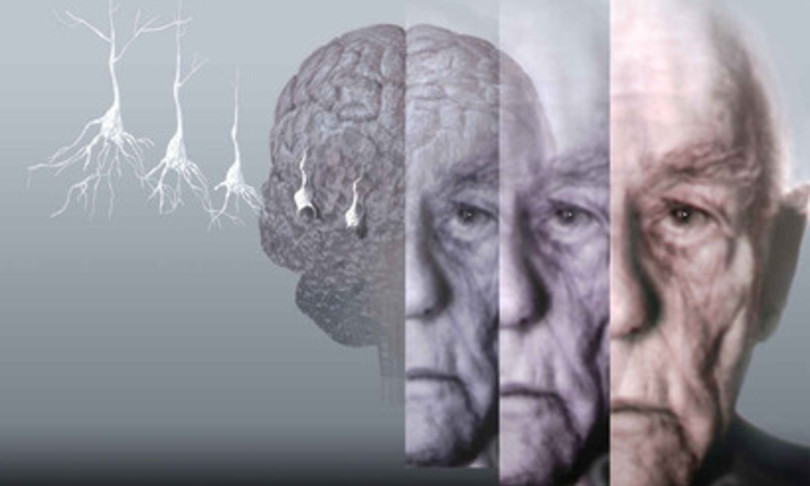 Fasci luce per studiare segreti cervello