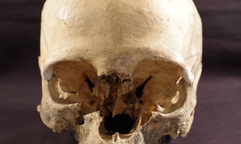 bologna trovato cranio donna preistoria rito funebre