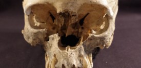 Il cranio di una donna svela un rituale di 5.000 anni fa