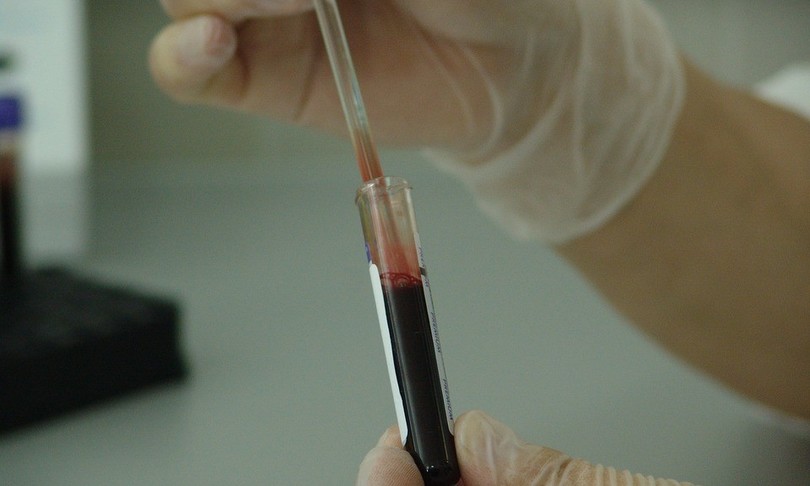 test sangue prevede quando si muore