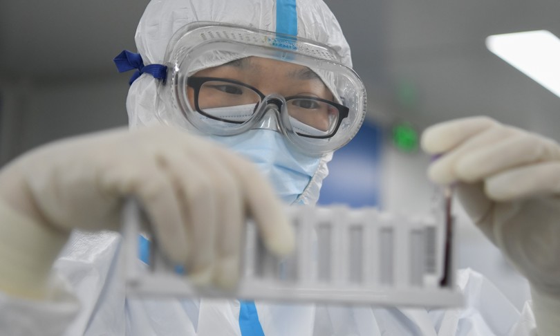 tre virologi cinesi Wuhan malati di Covid novembre 2019