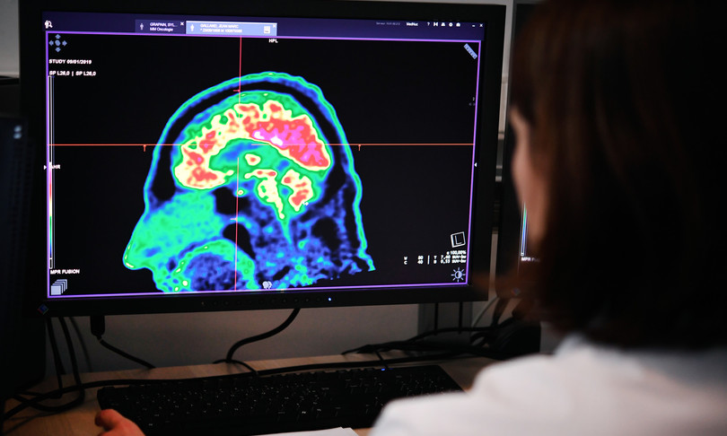 torna a parlare grazie a elettrodi nel cervello