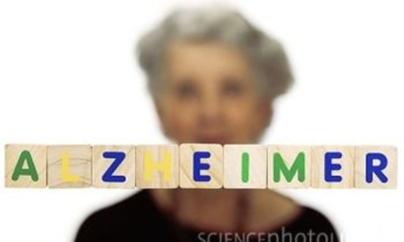 Alzheimer ricercatori italiani sviluppano anticorpo