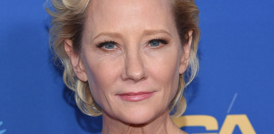 È morta l'attrice Anne Heche, spente le macchine che la tenevano in vita