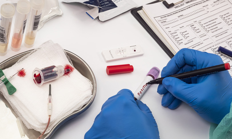 covid test italiano ci dira quando vaccinarci