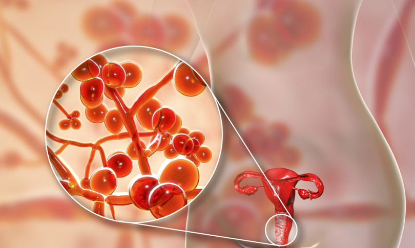 oms allarme impreparati a influenza fungina
