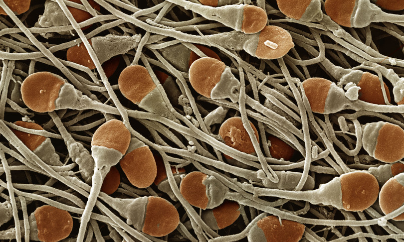 nuovo anticoncezionale maschile ferma sperma per 24 mesi