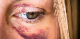 Violenza sulla donne, un'emergenza che resta difficile da eliminare