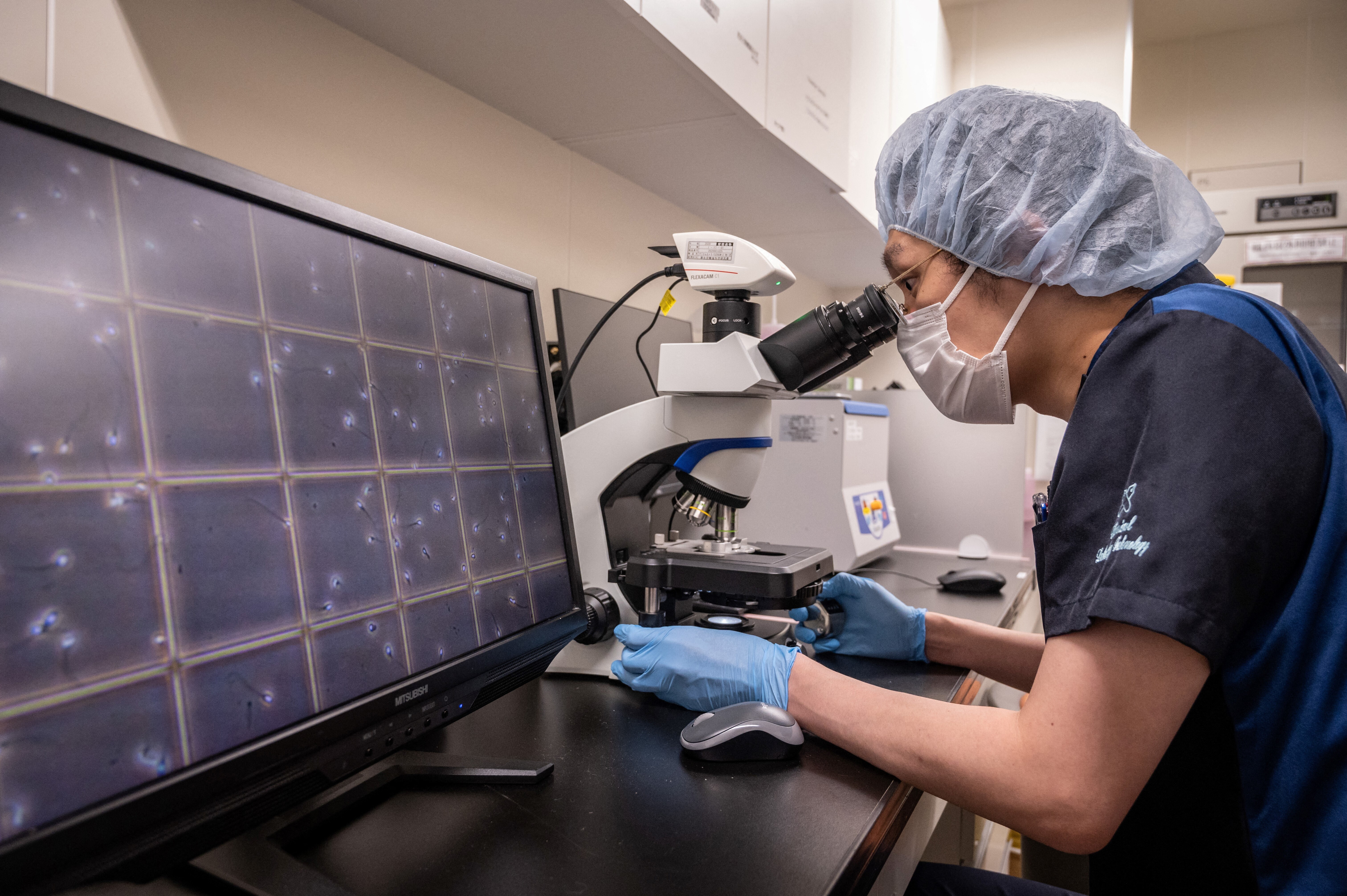 Un semplice esame del sangue può predire il Crohn con anni di anticipo