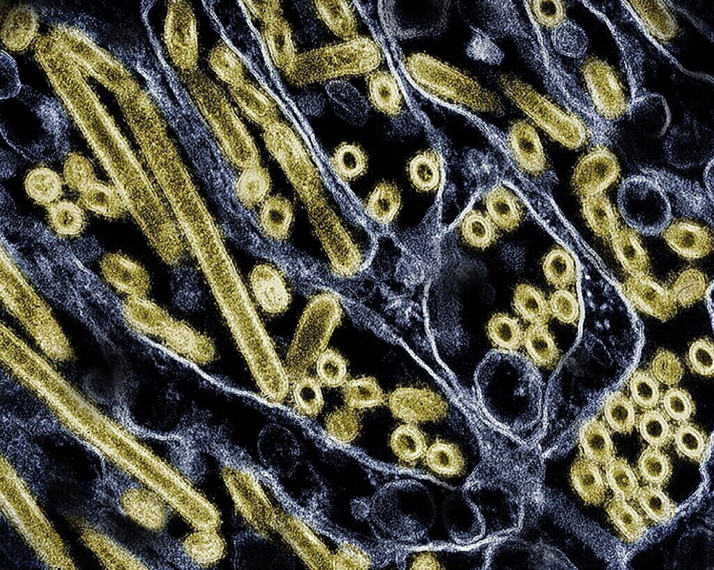 Scoperte le cellule immunitarie "esplosive" che proteggono il corpo