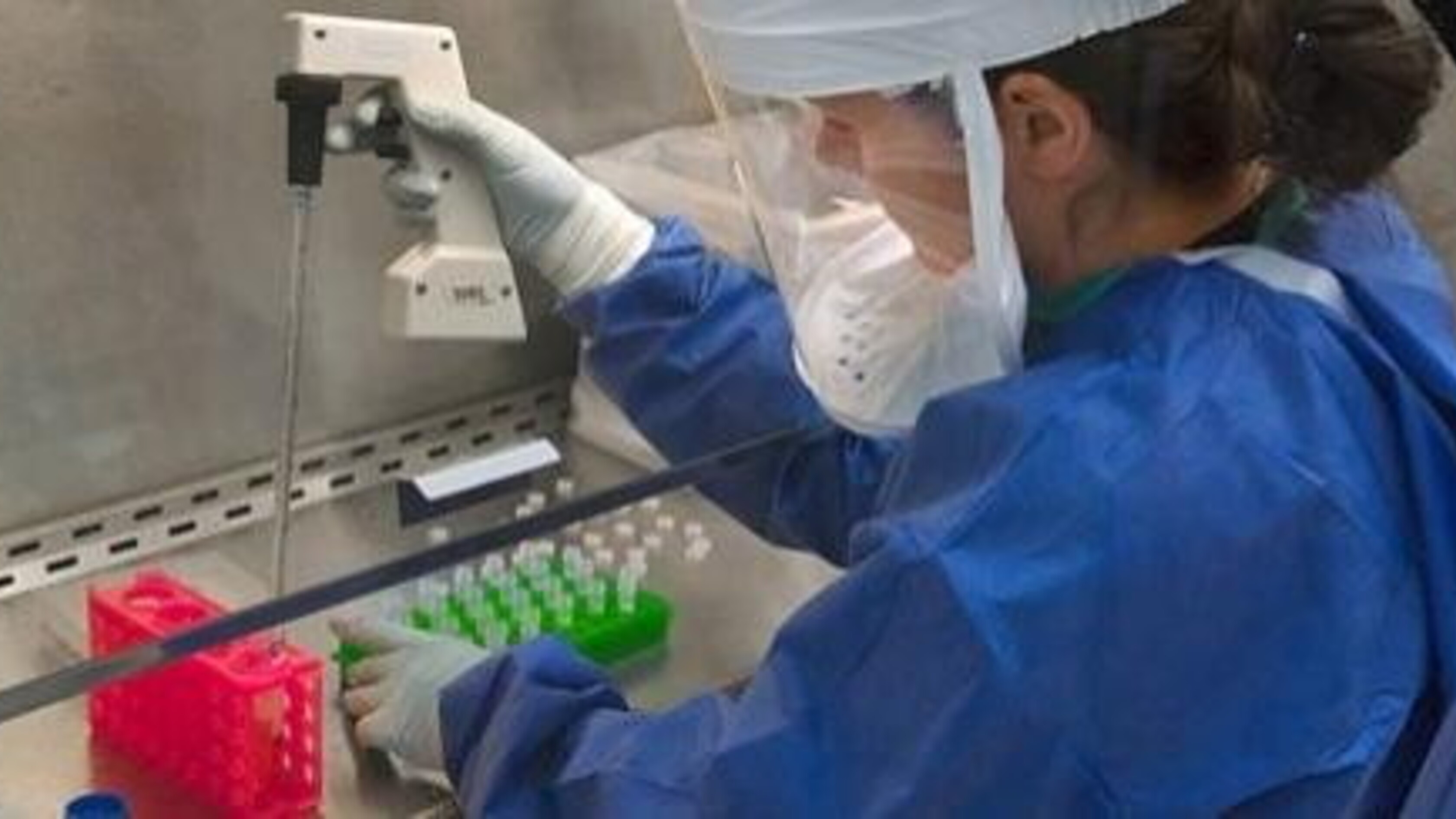 Vaccini anti HIV: dalla sperimentazione in Africa ancora un fallimento