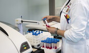 Un test del sangue può rivelare la presenza di un tumore