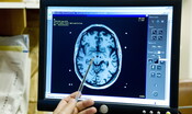 Scoperto come il cervello umano codifica l'esperienza