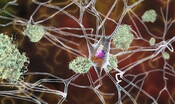 Da un nuovo farmaco passi avanti contro l'Alzheimer