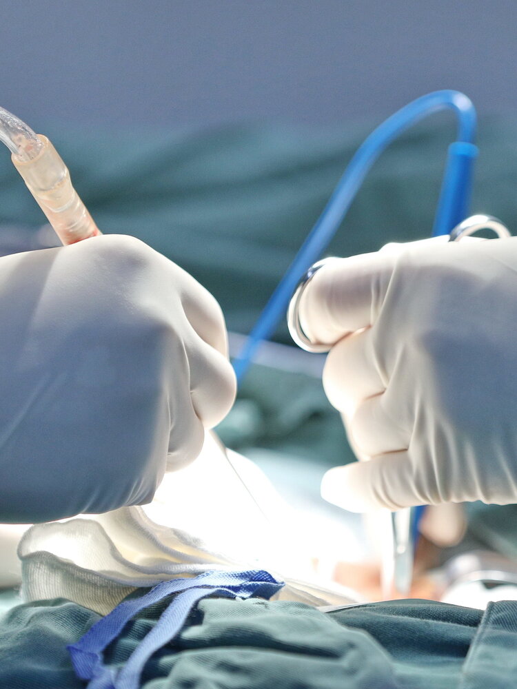 I primi interventi chirurgi in ipnoanestesia alle Molinette