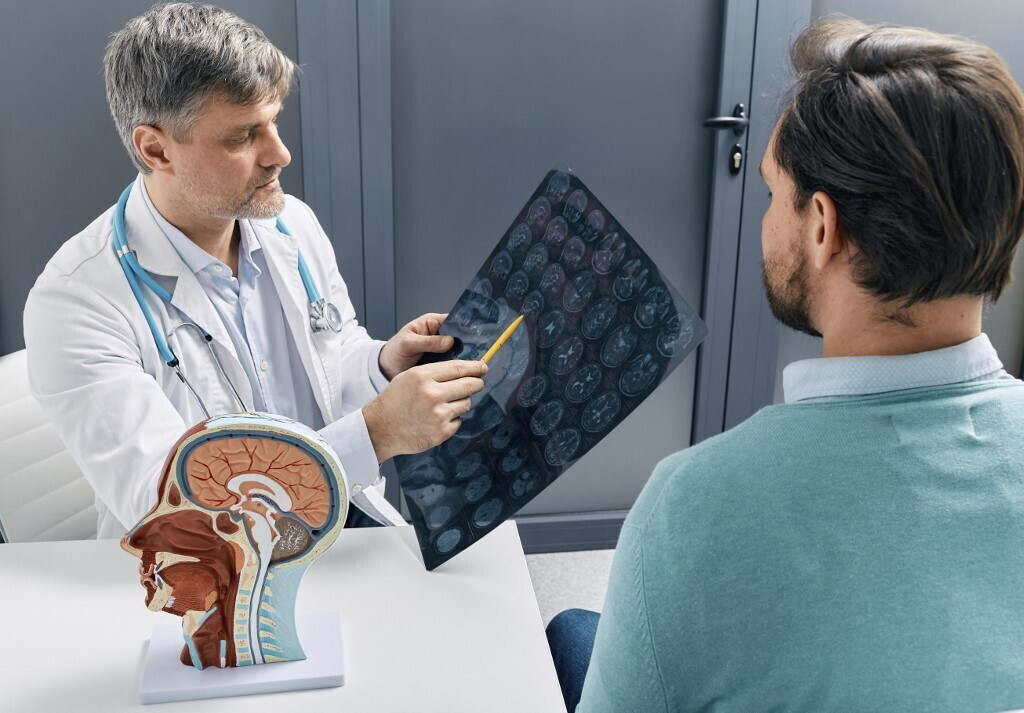 Dopo un ictus la stimolazione elettrica migliora la funzionalità del braccio