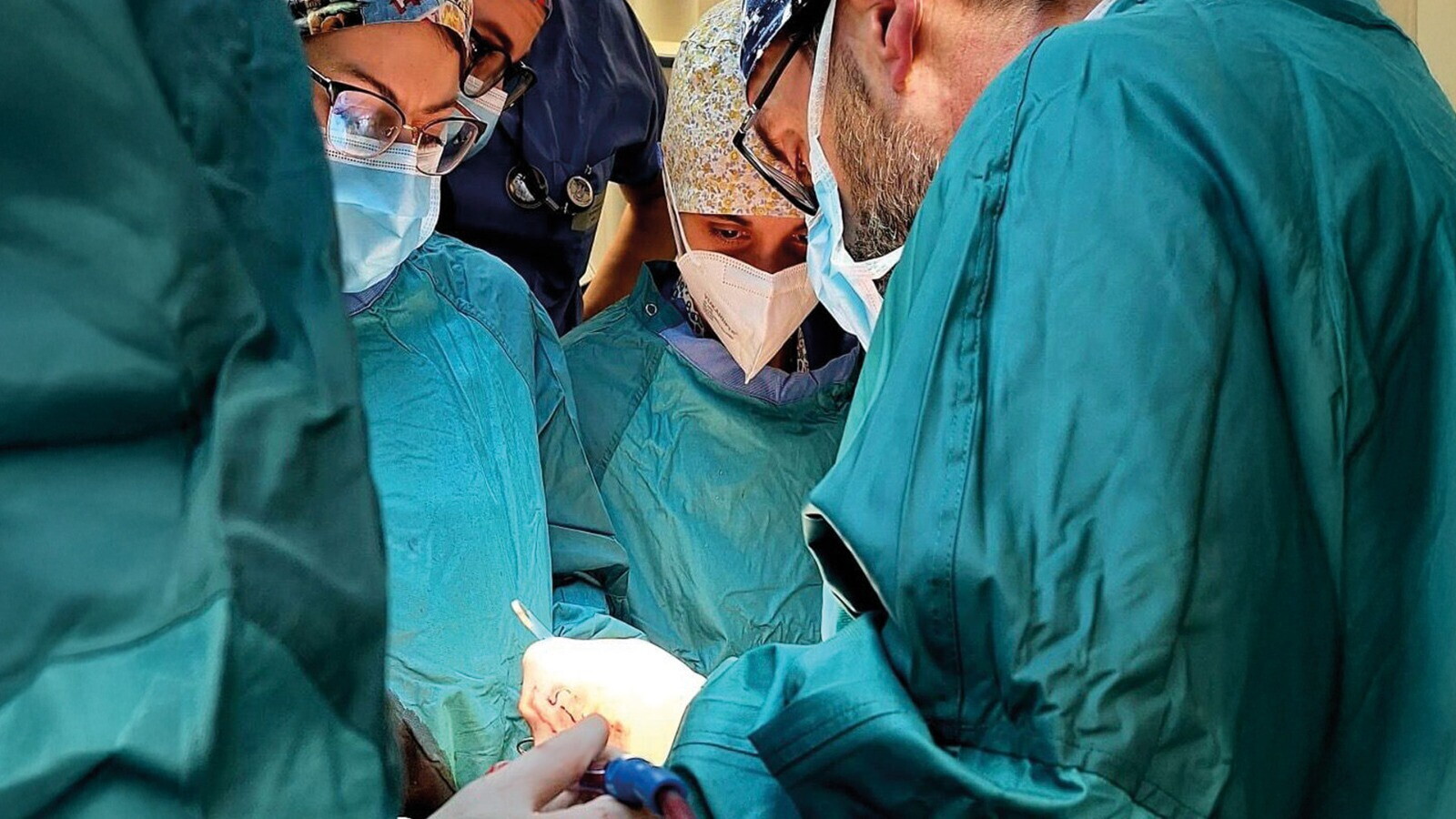 Come evitare i due anni di attesa per l'intervento di cataratta