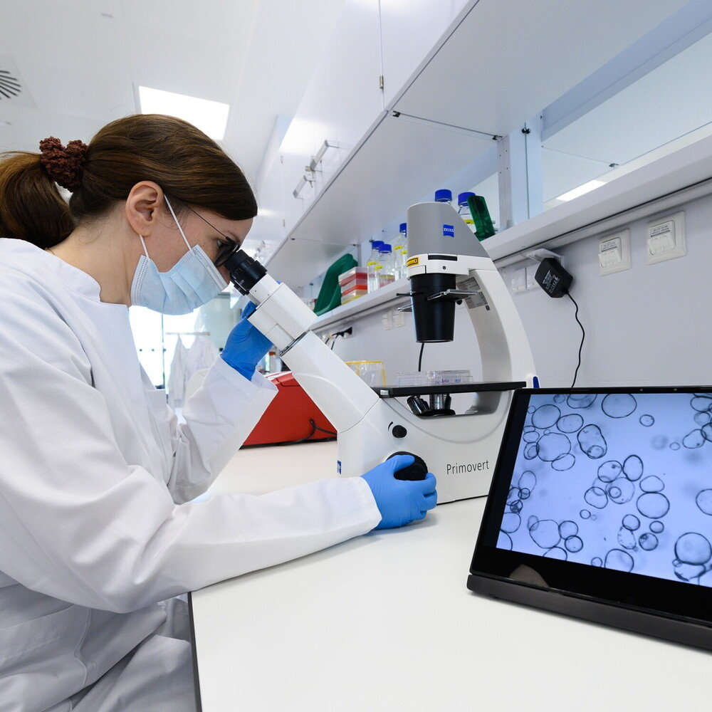 Trovata una via per superare la resistenza ai farmaci del glioblastoma