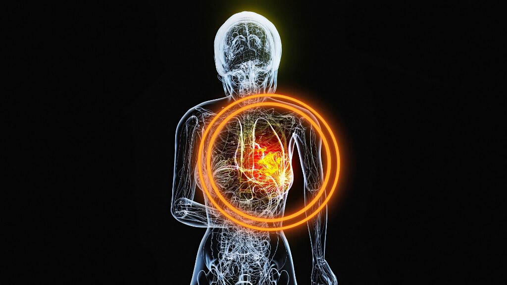 IA individua un terzo dei tumori al seno non diagnosticati durante lo screening
