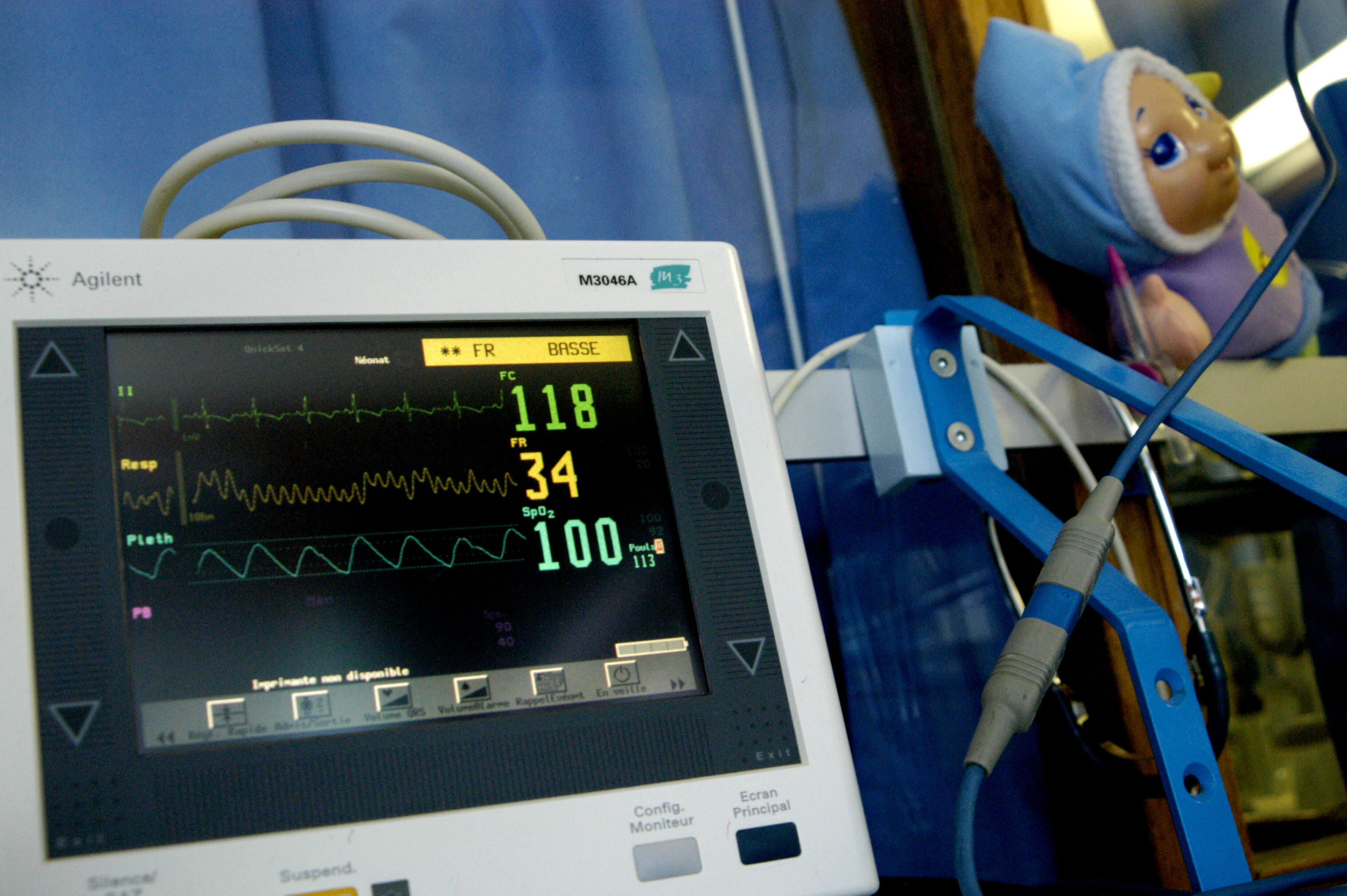 Bimbo col cuore bruciato: attesa per la decisione sul trapianto