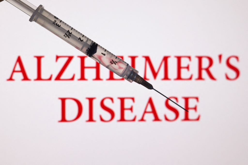 Un prelievo per “cronometrare” l’Alzheimer