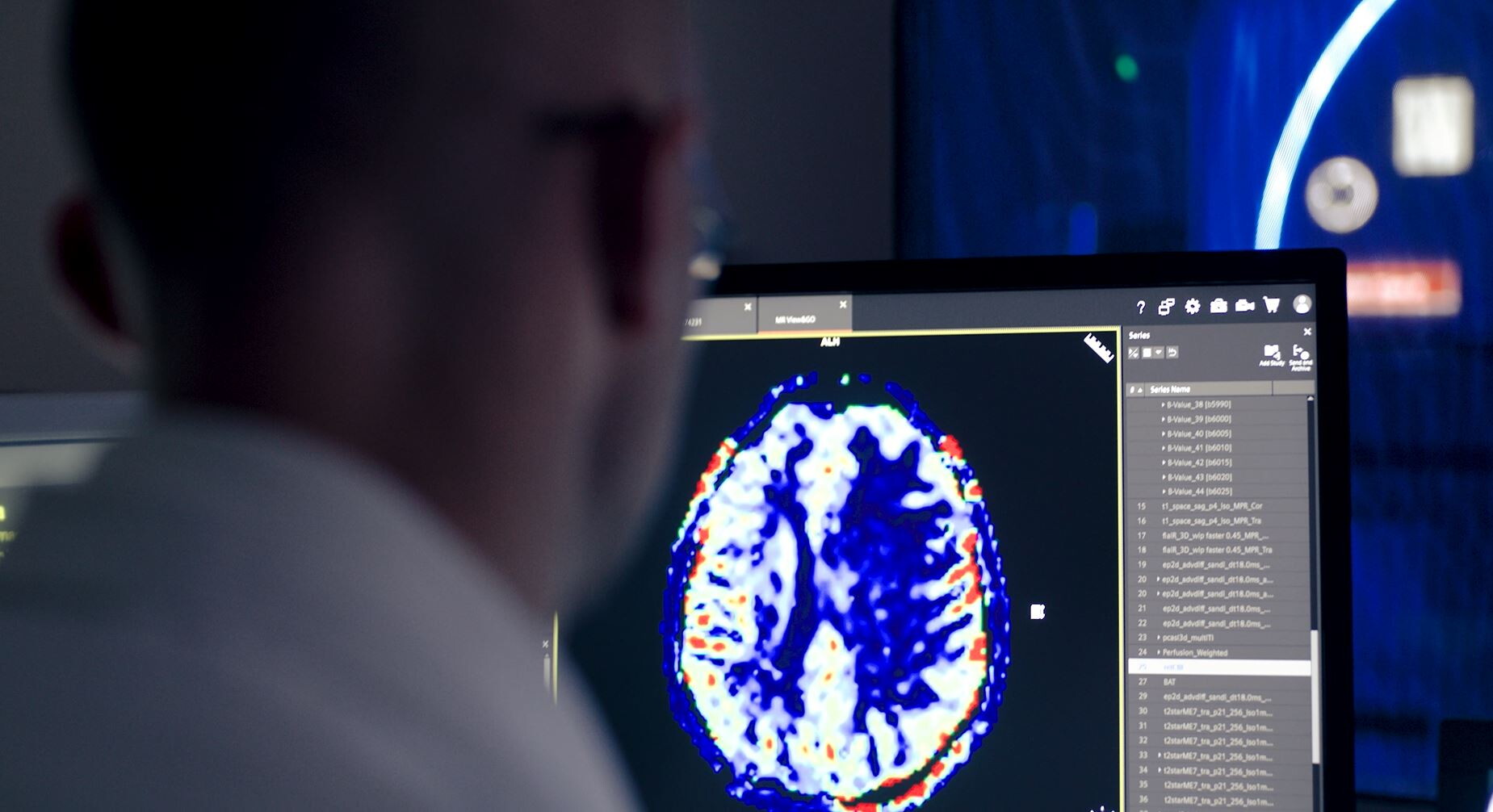 Più precisione, meno invasività: Humanitas accelera sulla ricerca