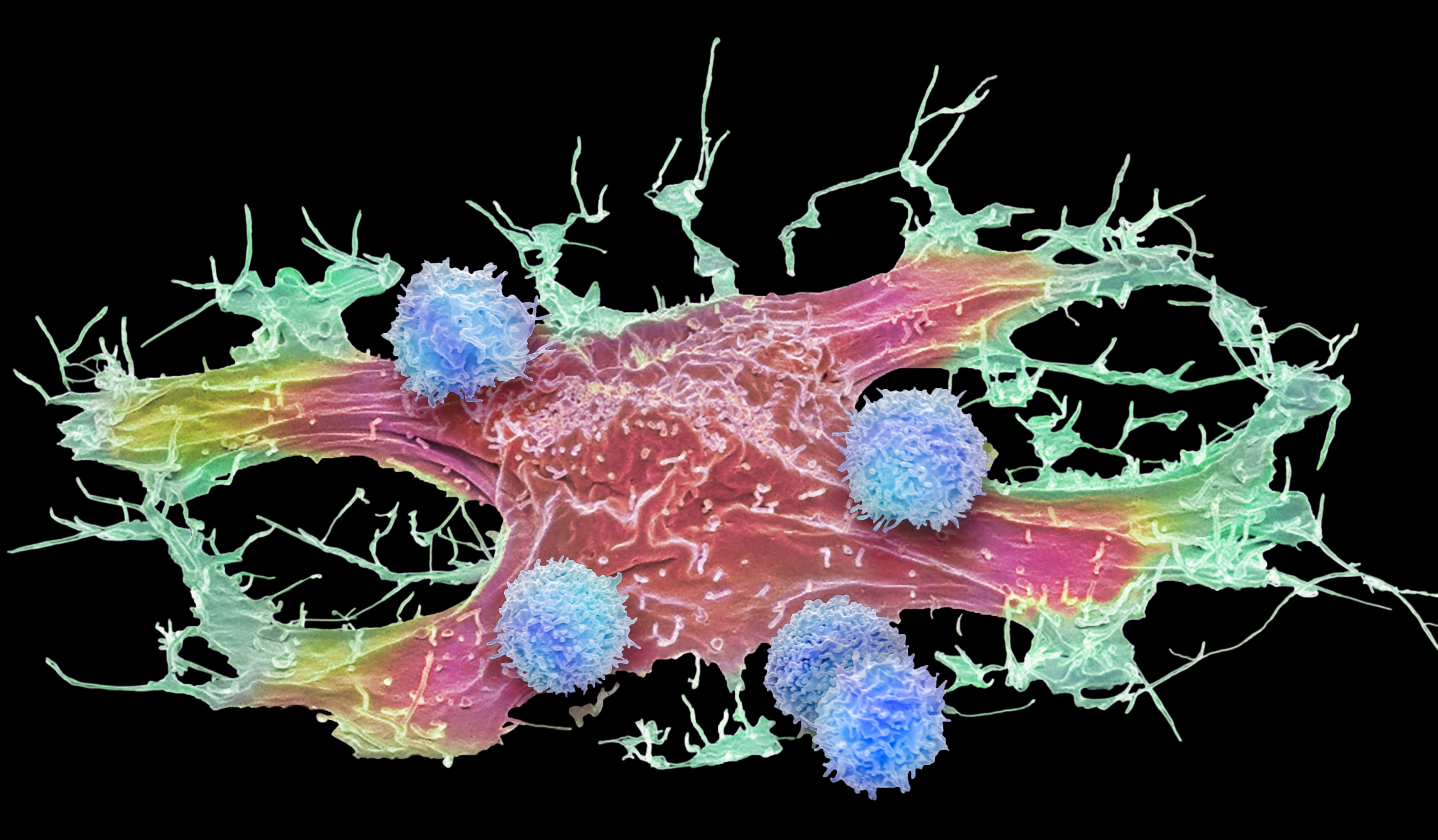Nuova cura 'pan-cancro': mix di farmaci blocca la crescita tumorale