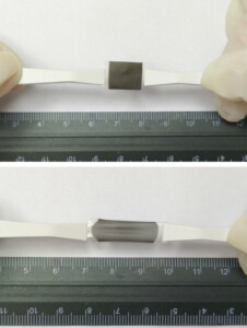 Un cerotto elimina il melanoma senza l'intervento chirurgico