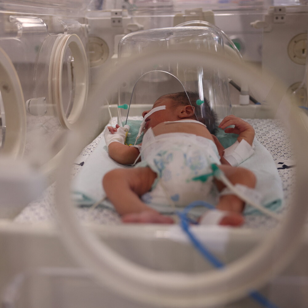 Una mamma trapiantata dà alla luce due gemelle a Catania