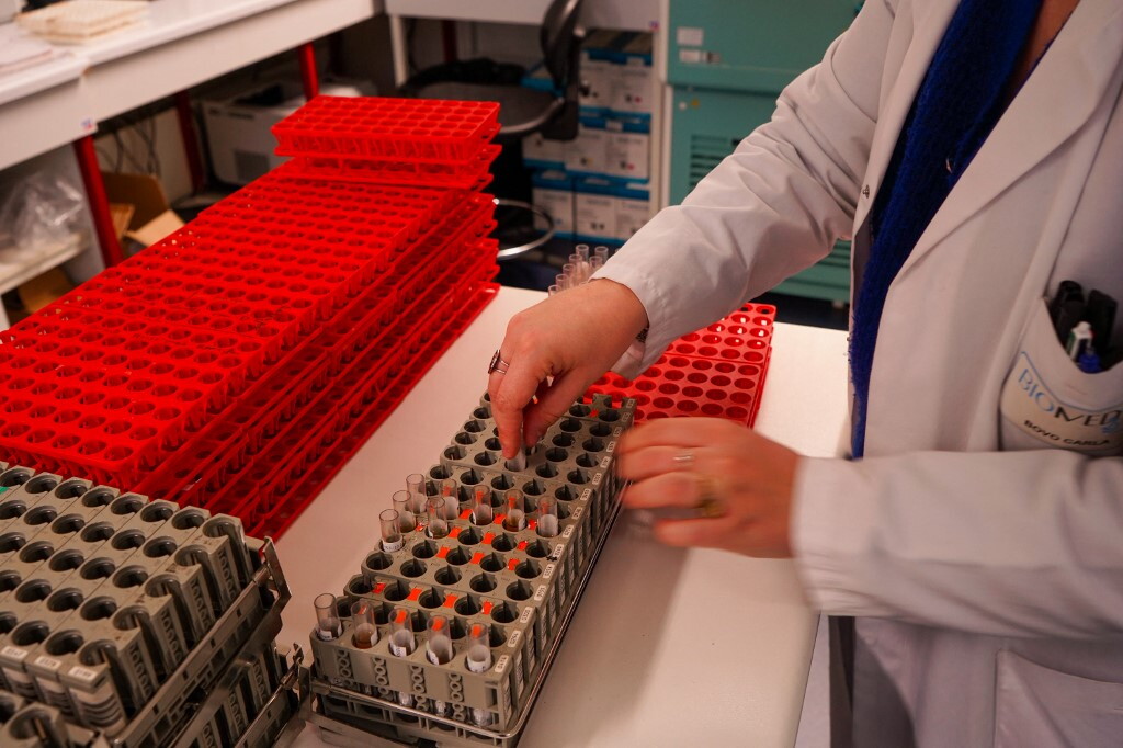 Tripla pillola riduce le recidive di ictus del 39%