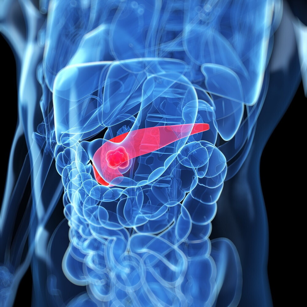 The study on pancreatic cancer that promised a turning point has been withdrawn