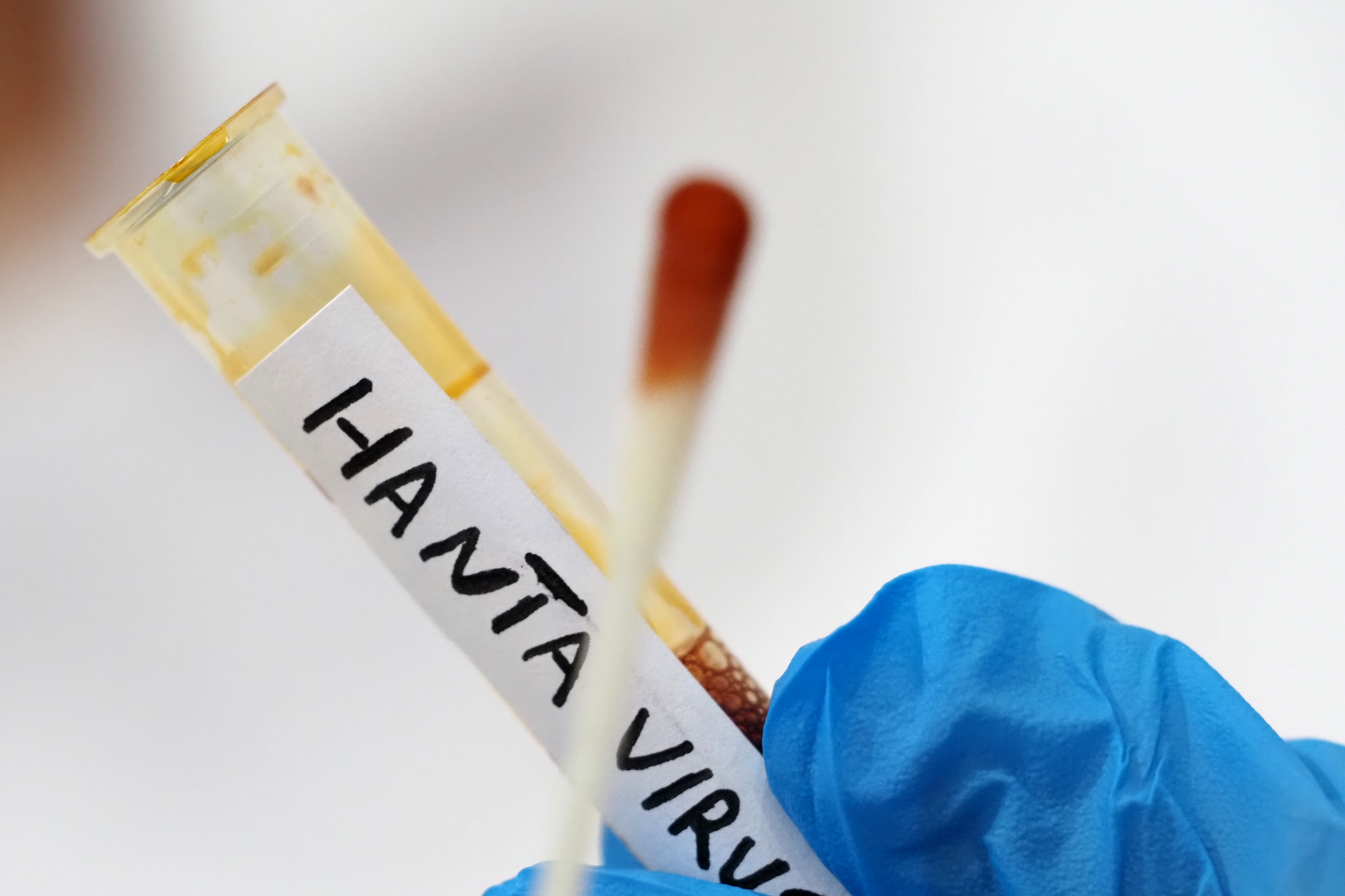 Hantavirus: ministro, negativi tutti e 4 i test dei pazienti isolati in Italia