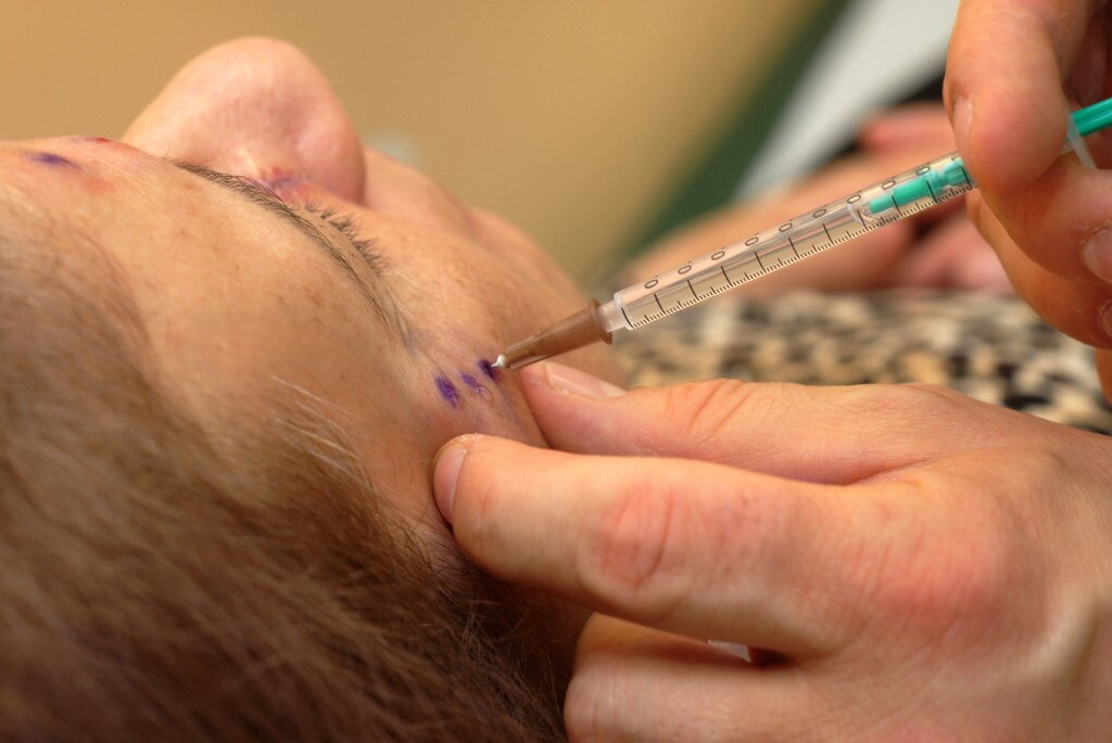 Medicina estetica, boom di "ritocchini" fra gli uomini
