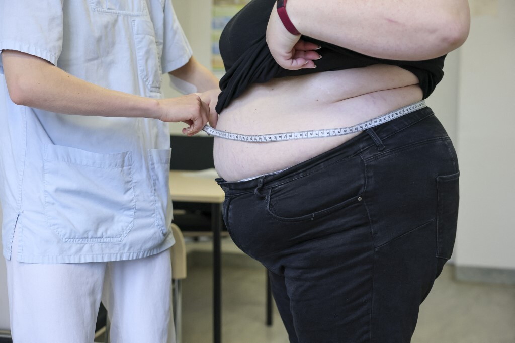 Obesità in calo tra i giovani nei paesi ad alto reddito, all'allarme per i paesi più poveri