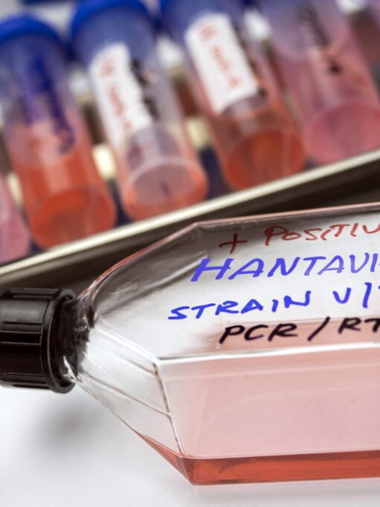 Hantavirus: lo studio ISS‑FBK conferma la bassa capacità epi