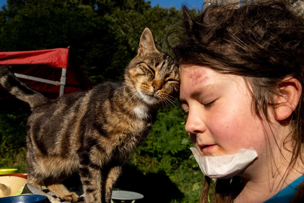 Il pelo del gatto non peggiore l'asma. Lo rivela uno studio