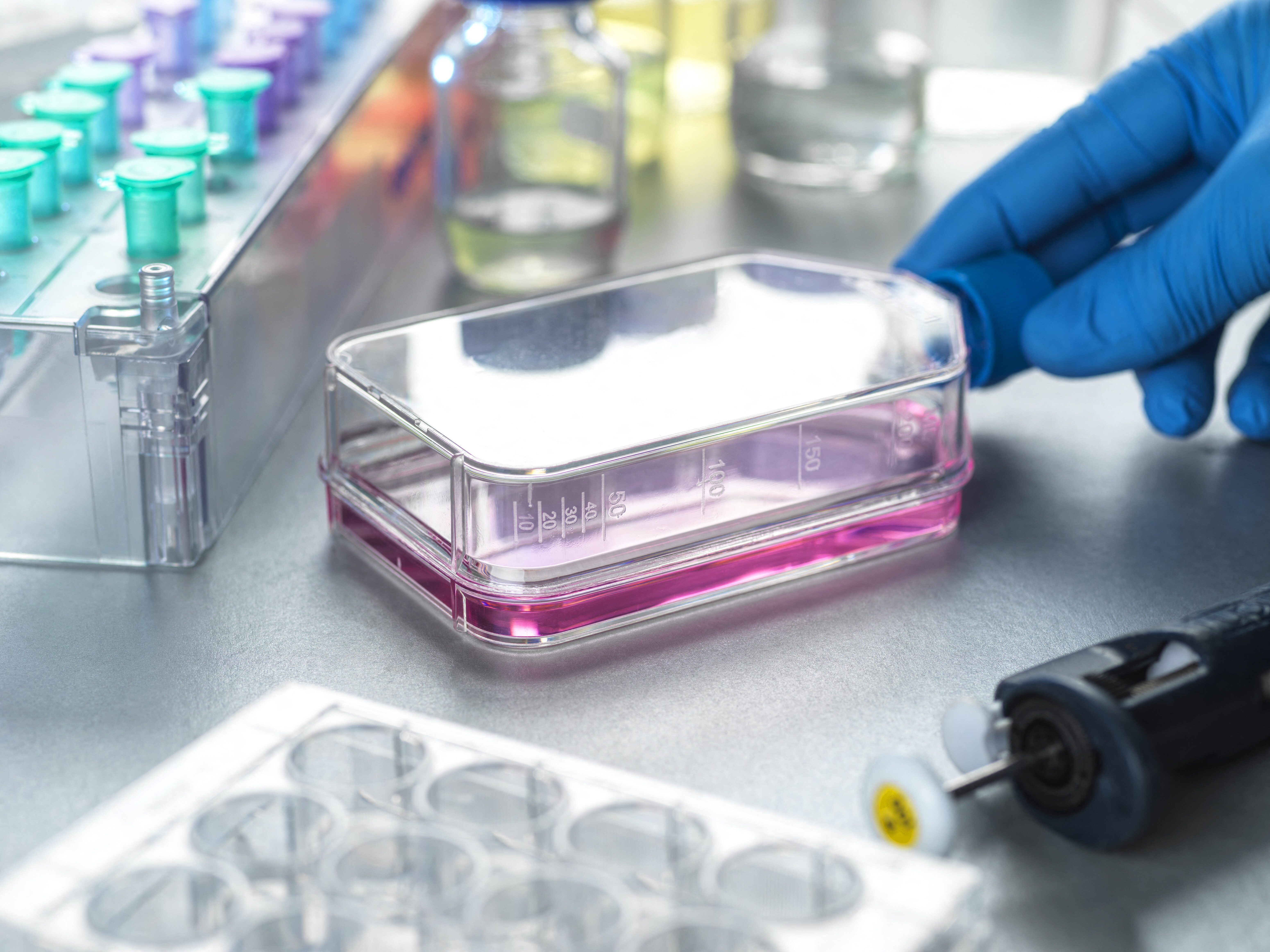 Tumori, scoperto 'l'interruttore' per 'spegnere' le difese del corpo