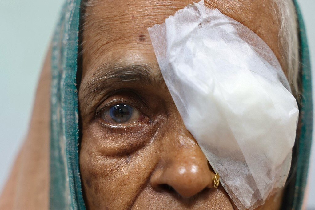 In India lo screening della cataratta passa dallo smartphone