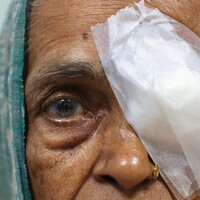 In India lo screening della cataratta passa dallo smartphone
