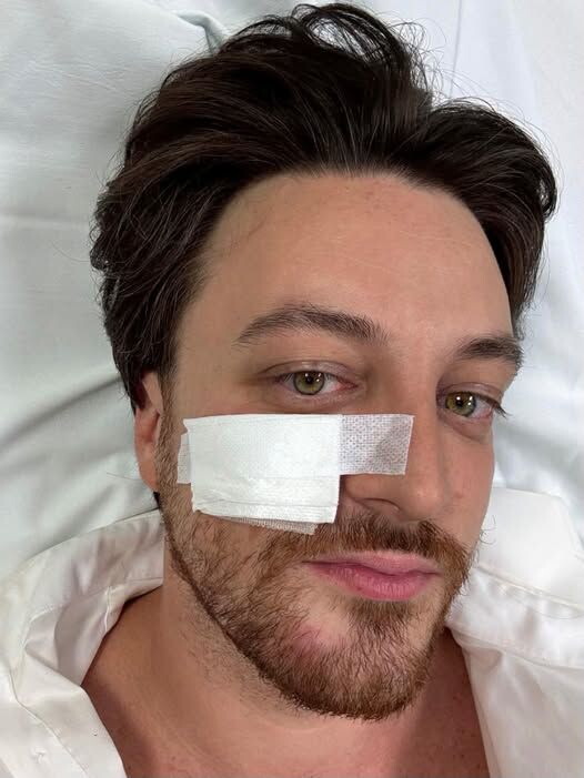 Incidente stradale per Alberto Stefani: "Ho rischiato ma sto bene"