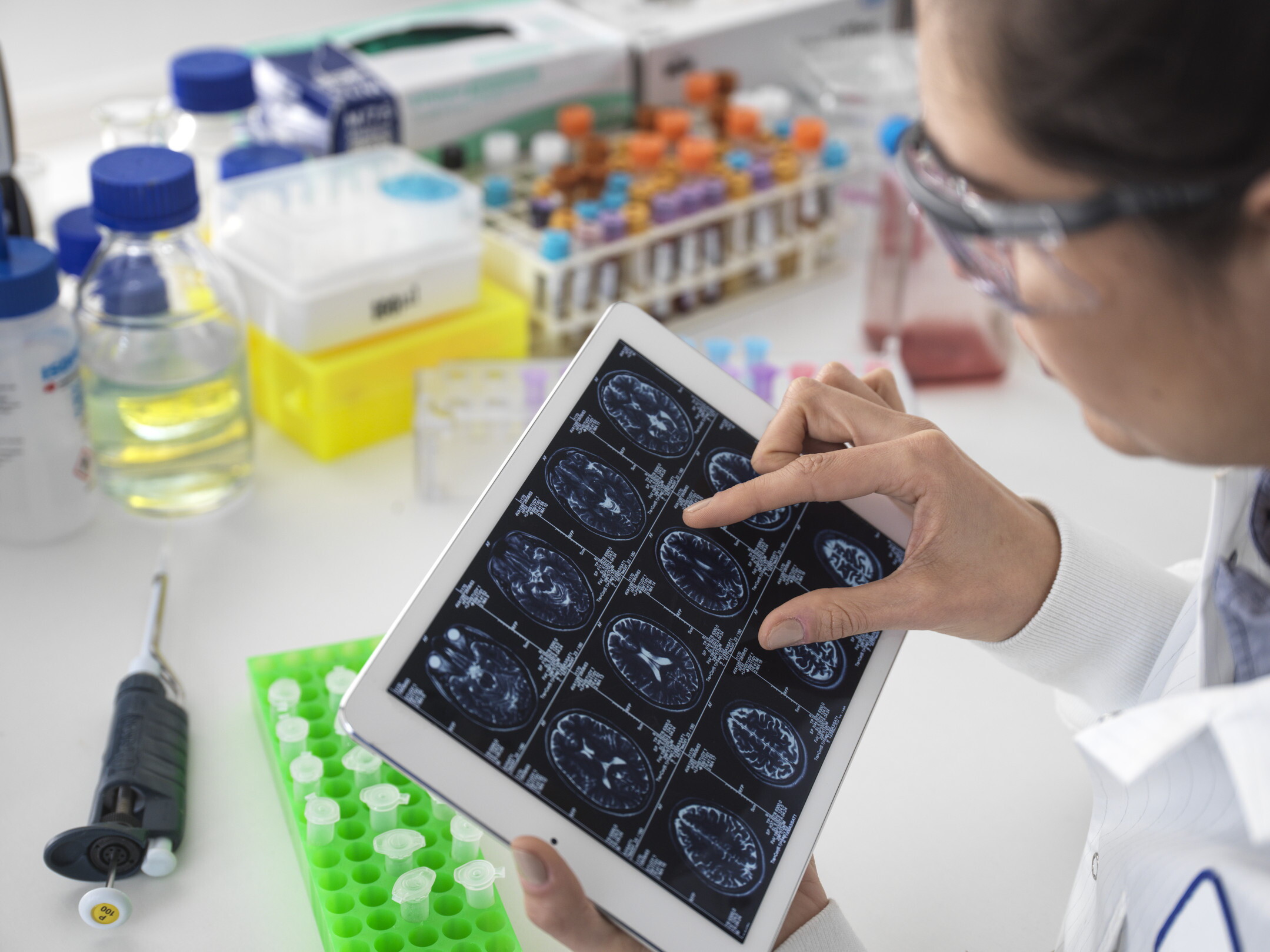 La voce può rivelare l'età biologica del cervello