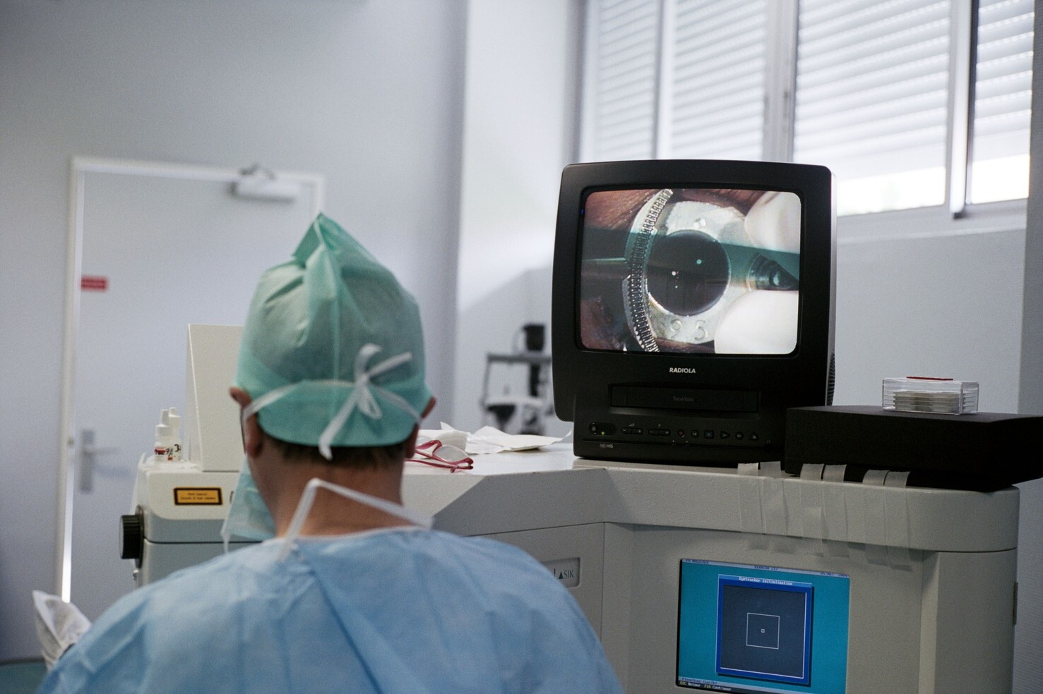 La presbiopia si potrà curare con un collirio