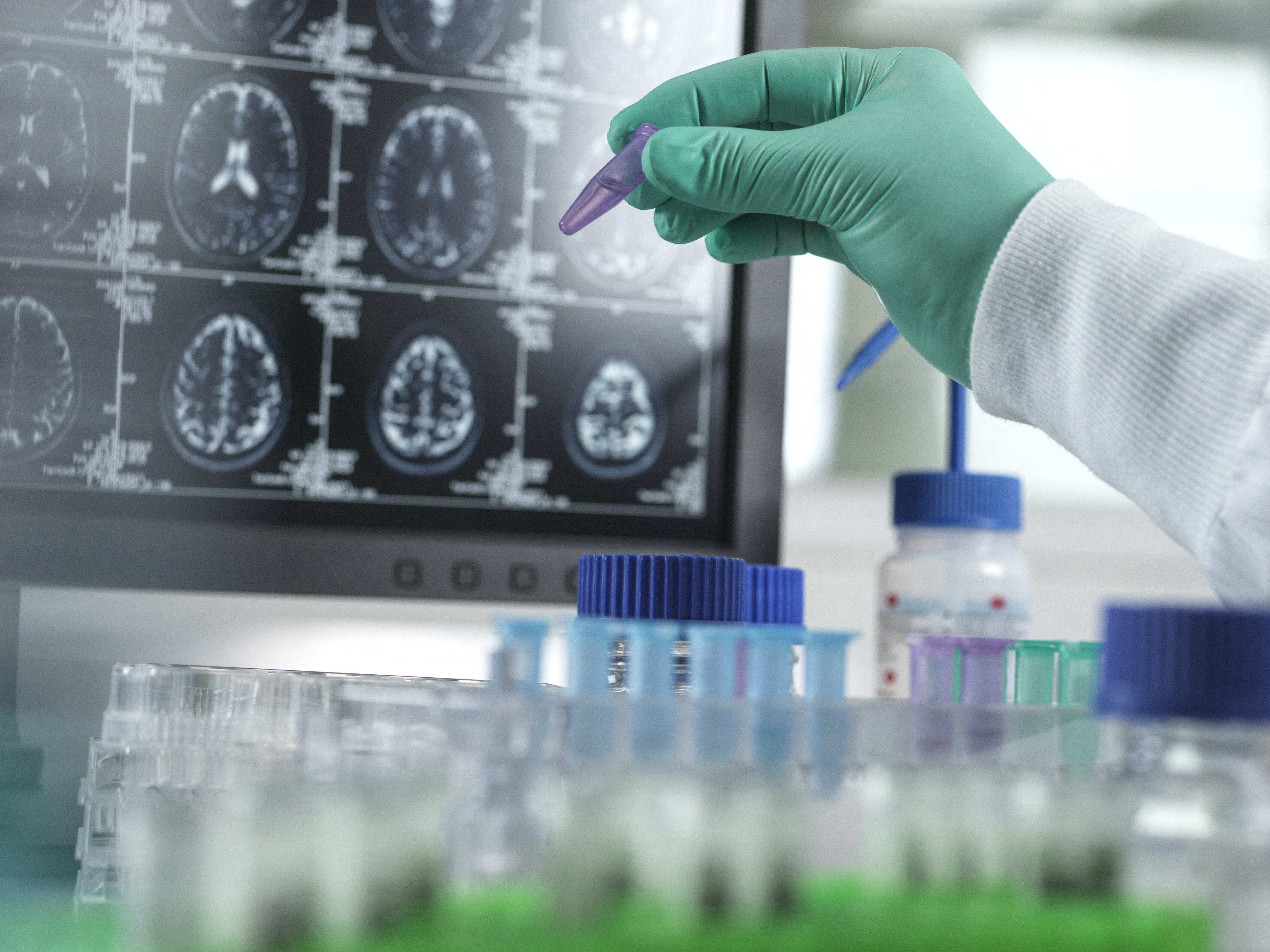 Il vaccino contro l'herpes zoster può prevenire la demenza